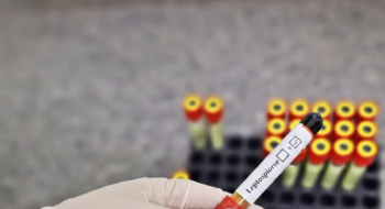 HDT alerta para cuidados essenciais contra a leptospirose no período chuvoso